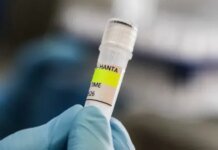 У ЦГЗ назвали, що може допомогти убезпечитися від хантавірусу